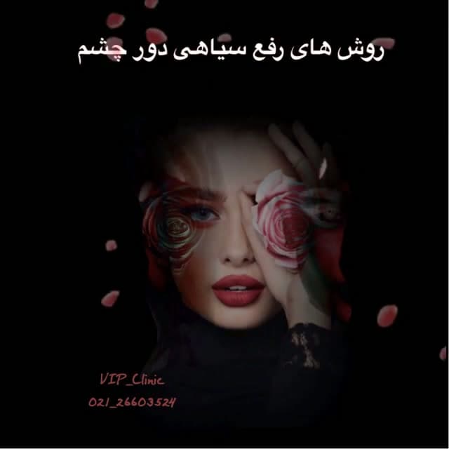 درمان طبیعی سیاهی دور چشم؛ از چای کیسه‌ای تا ماسک خیار