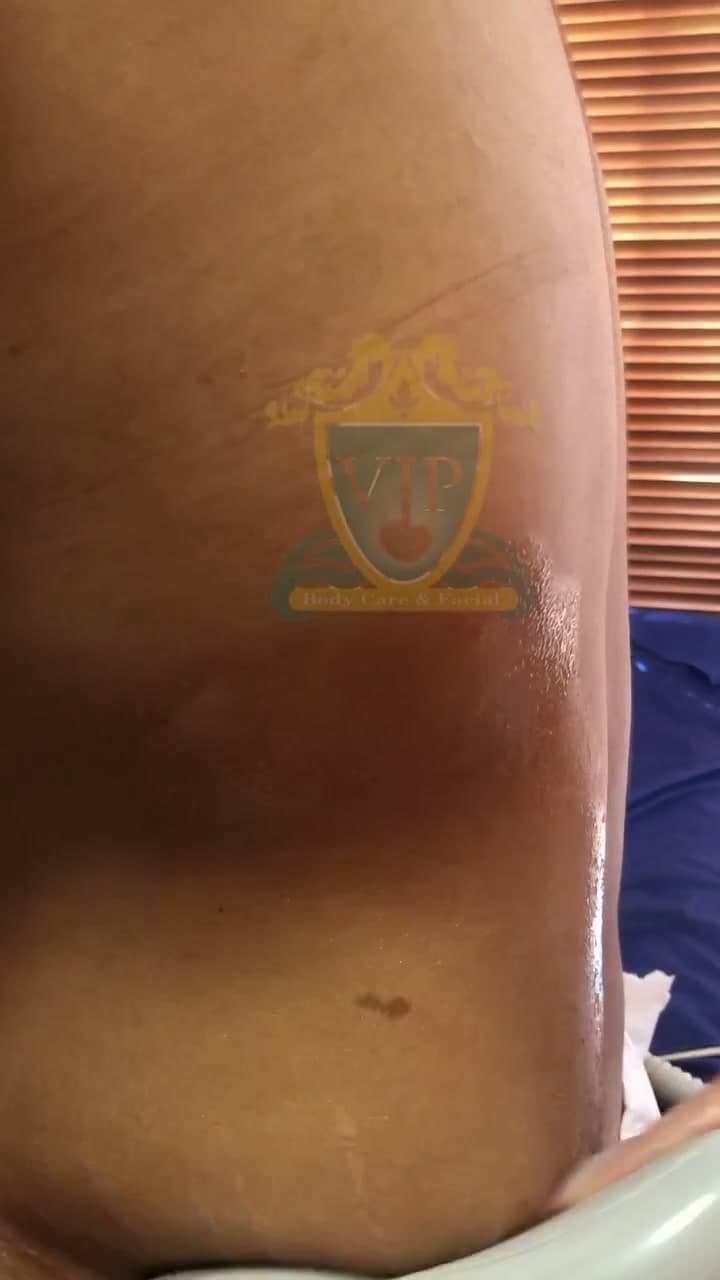 دستگاه لاغری اکسیلیس؛ لاغری بدون جراحی و بدون دوره نقاهت