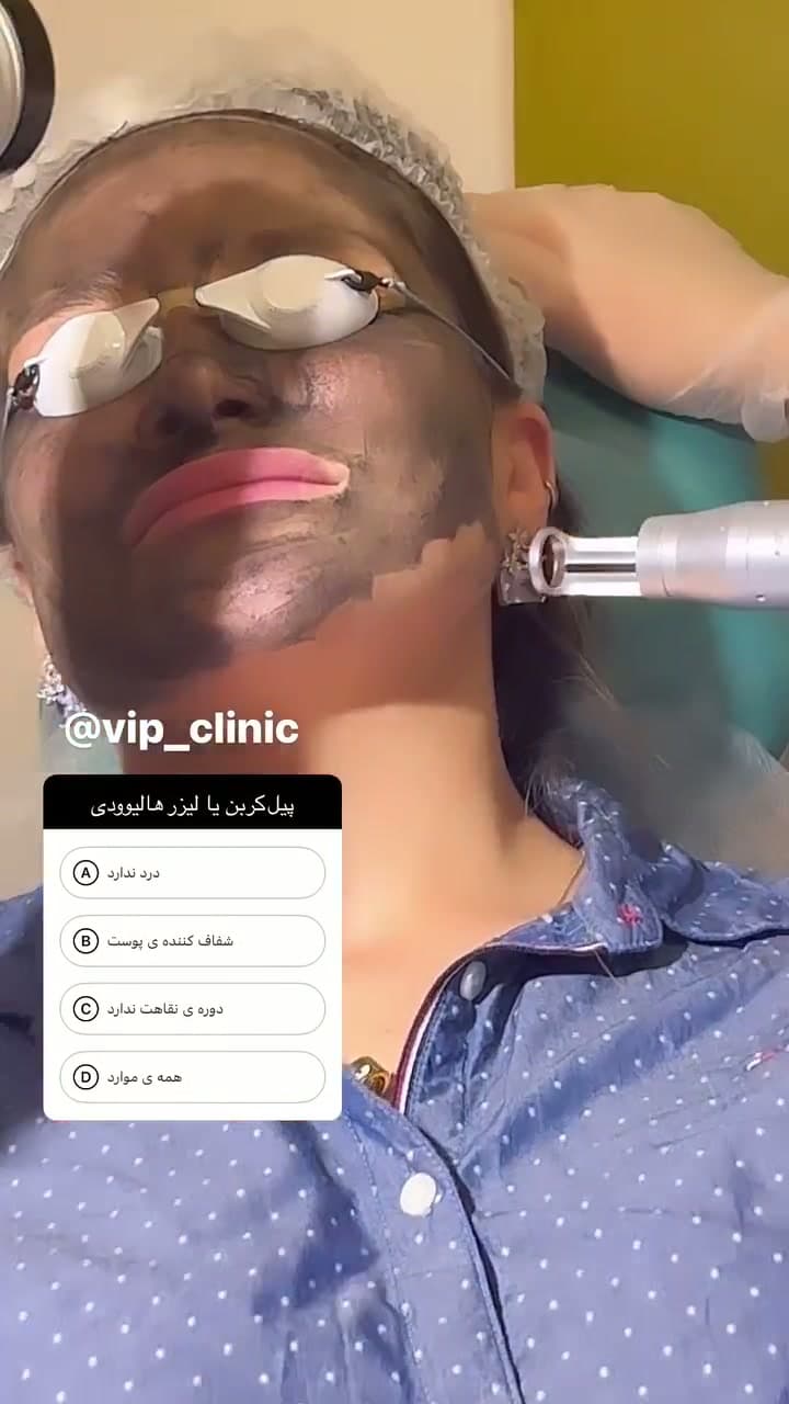 کربن لیزر با دستگاه هلیوس ۳؛ شفافیت، لیفت و جوانسازی پوست