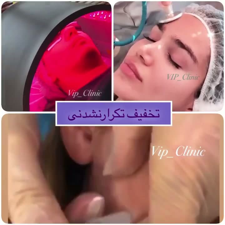 پکیج پوست شهریور؛ میکرودرم، هیدرودرمی پلاسما و فوتوتراپی