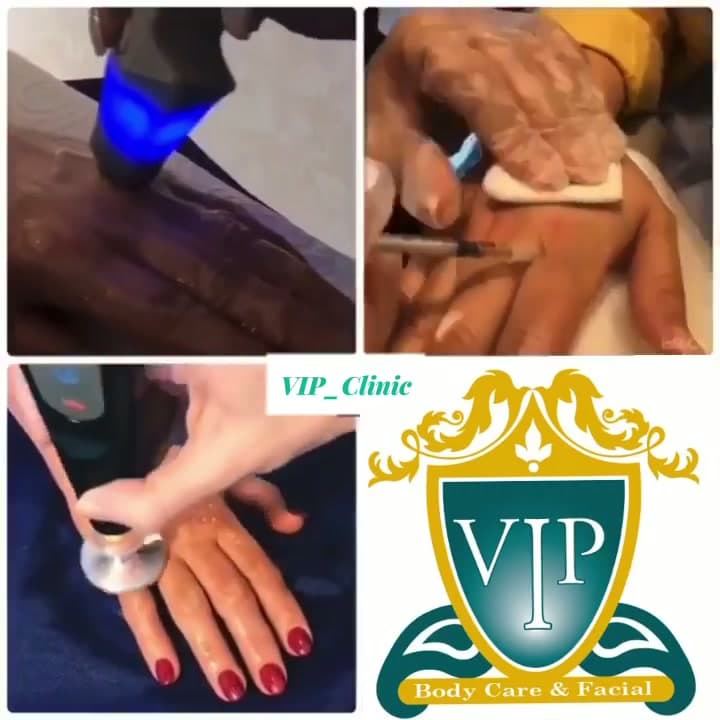 جوانسازی و لیفت دست در یک جلسه؛ ترکیب آراف پروتیج و مزوژل