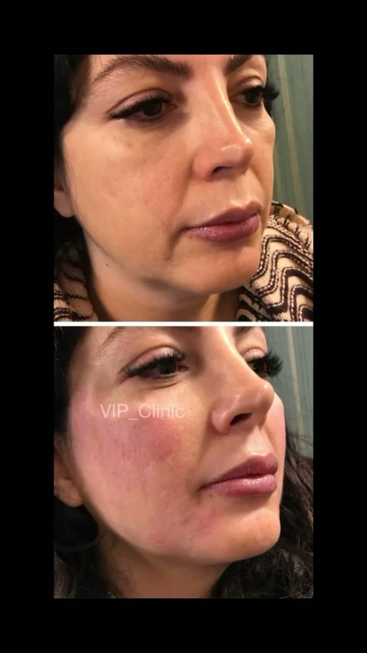 چالش حدس خدمات زیبایی؛ تصویر قبل و بعد مراجعهکننده کلینیک